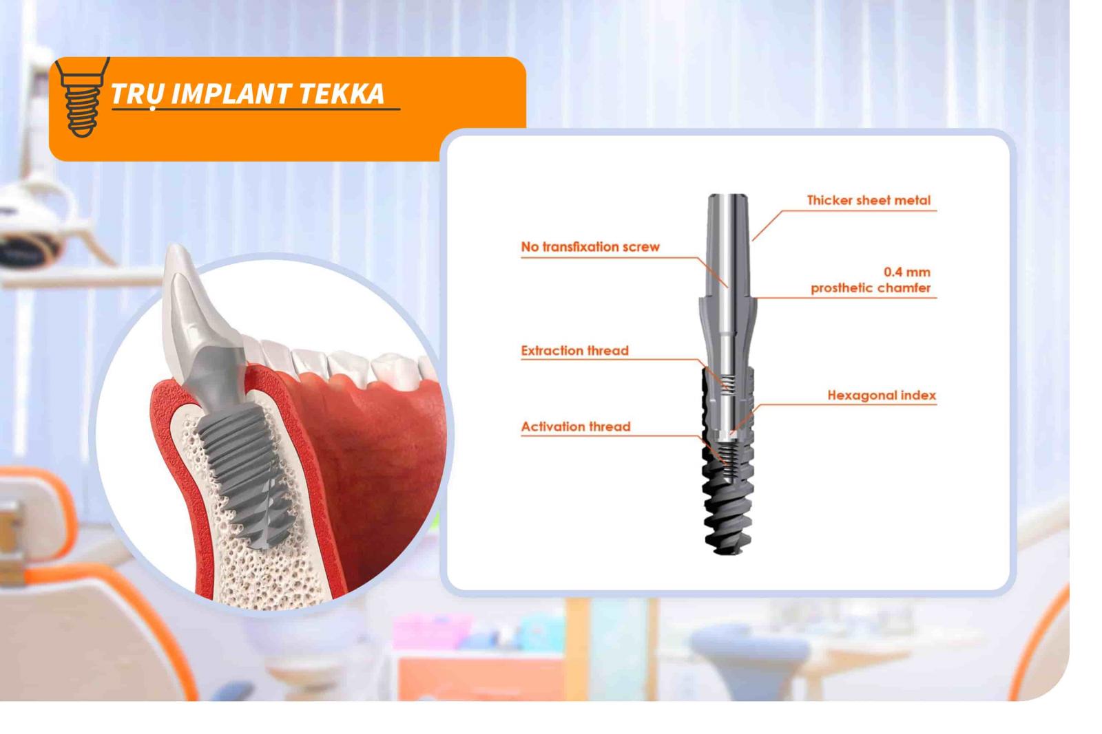 Trụ Implant Tekka