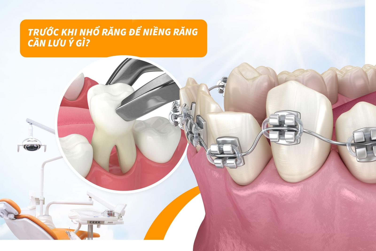 Trước khi nhổ răng để niềng răng cần lưu ý gì?