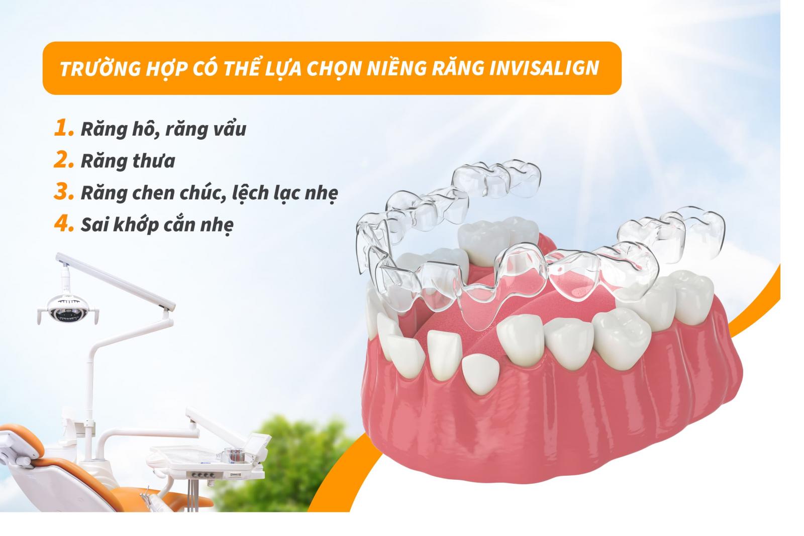 Trường hợp có thể lựa chọn niềng răng Invisalign