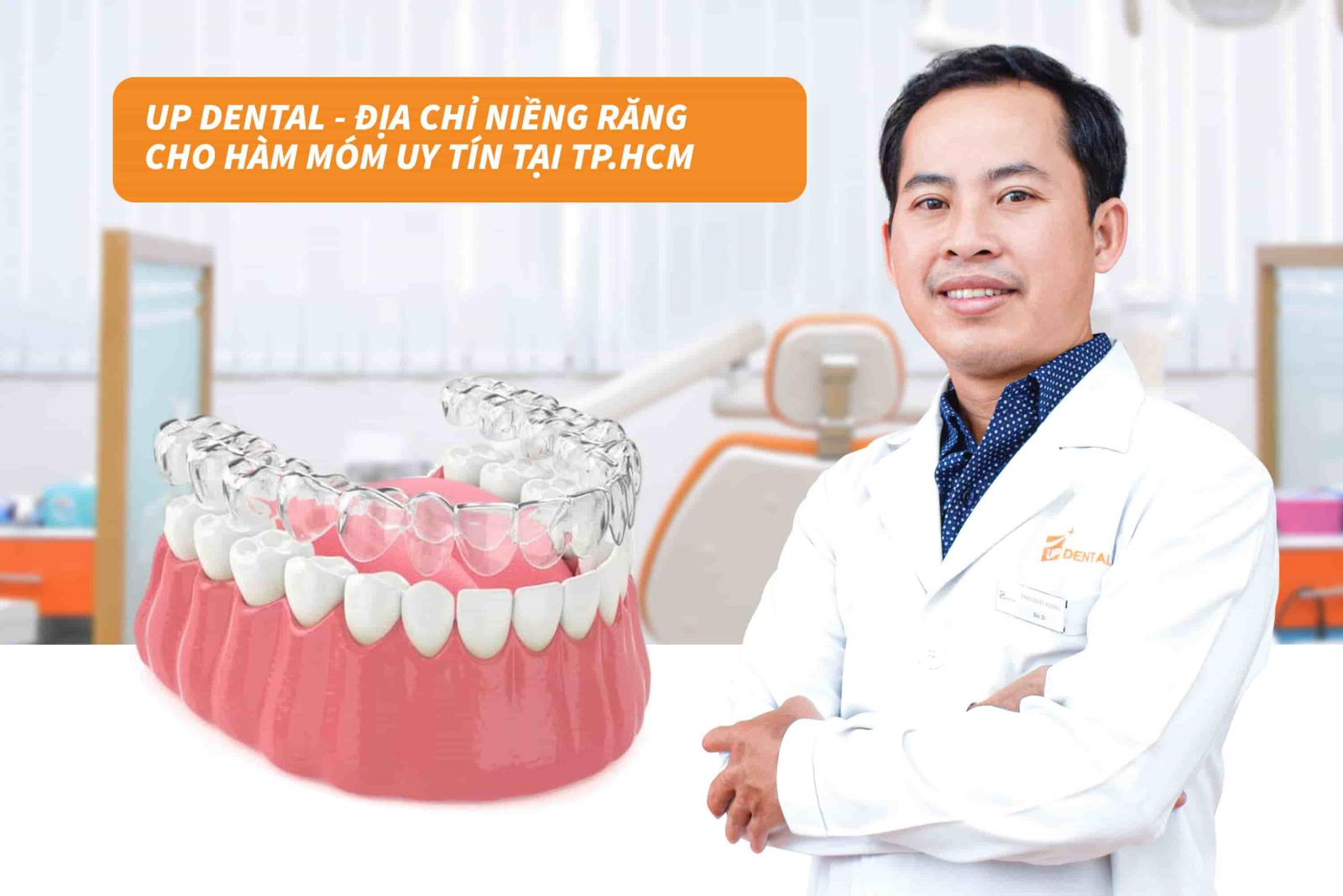 Up Dental - Địa chỉ niềng răng cho hàm móm uy tín tại TP.HCM 