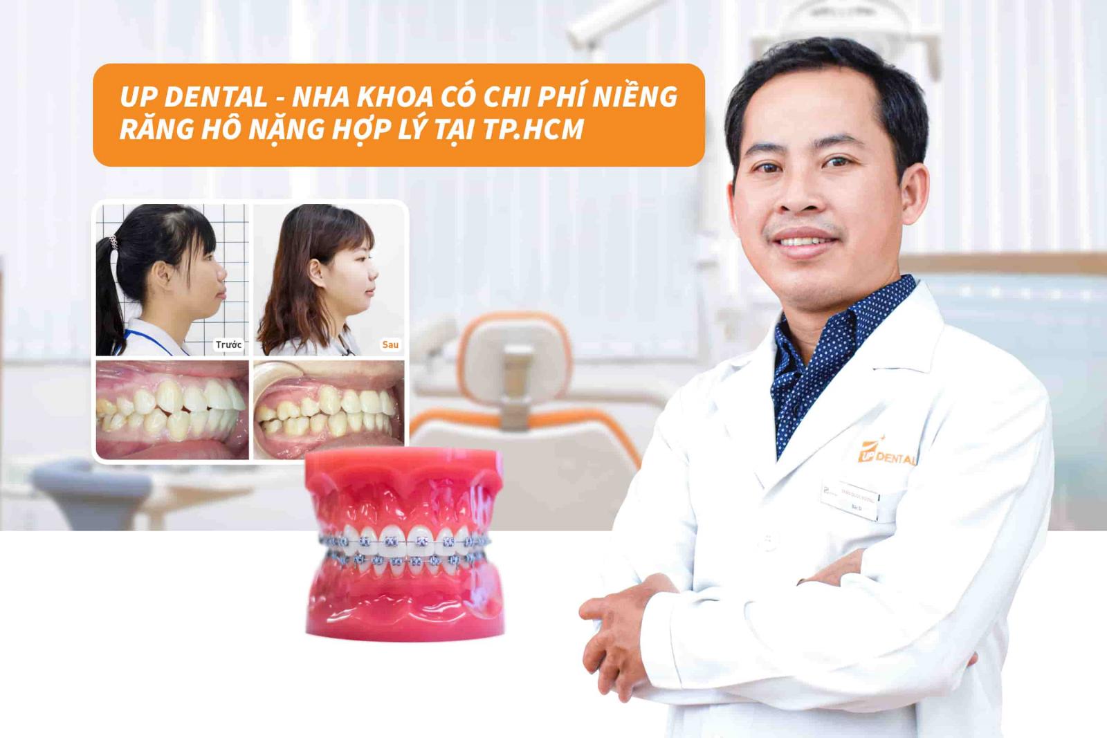 Up Dental - Nha khoa có chi phí niềng răng hô nặng hợp lý tại TP.HCM