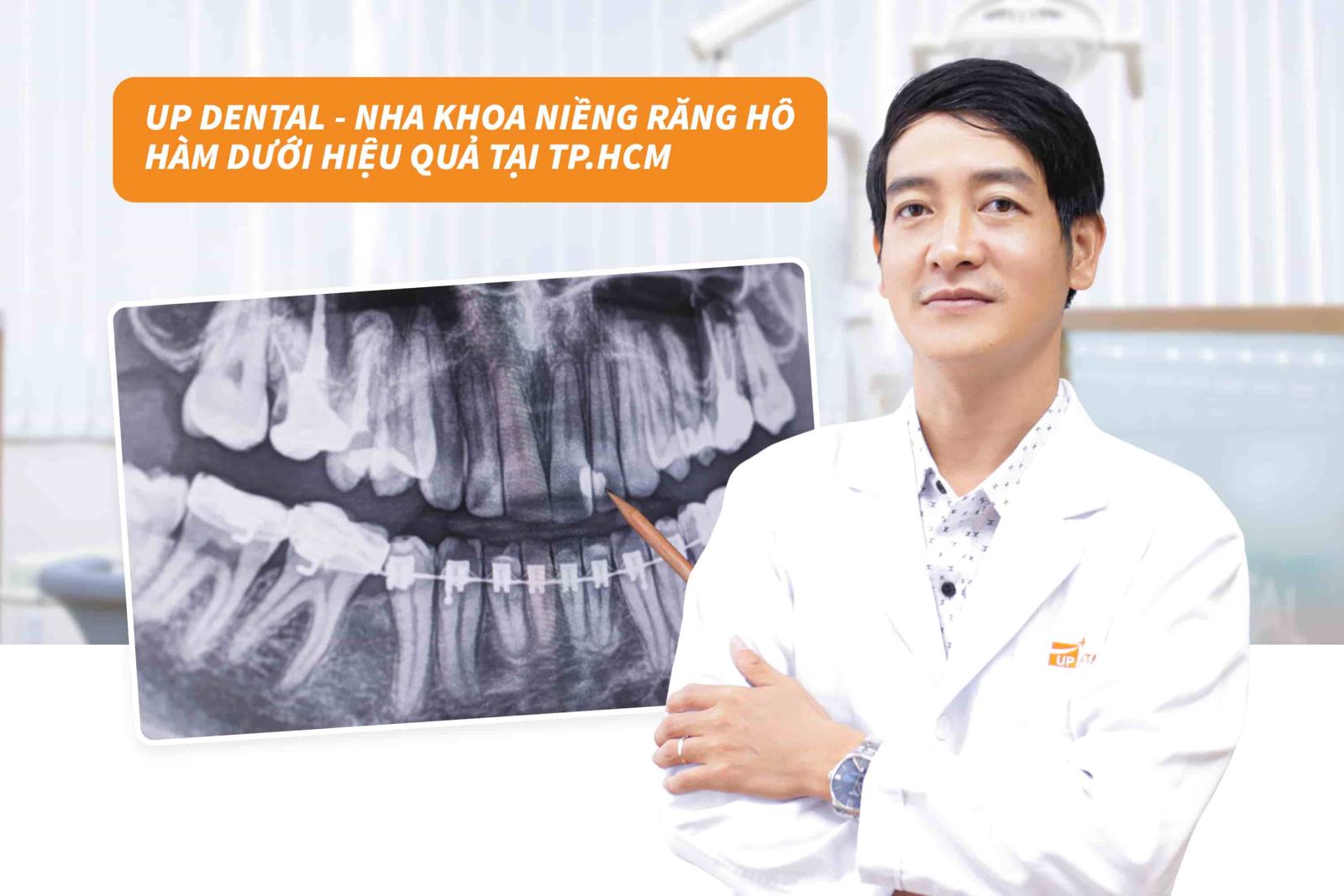 Up Dental - Nha khoa niềng răng hô hàm dưới hiệu quả tại TP.HCM