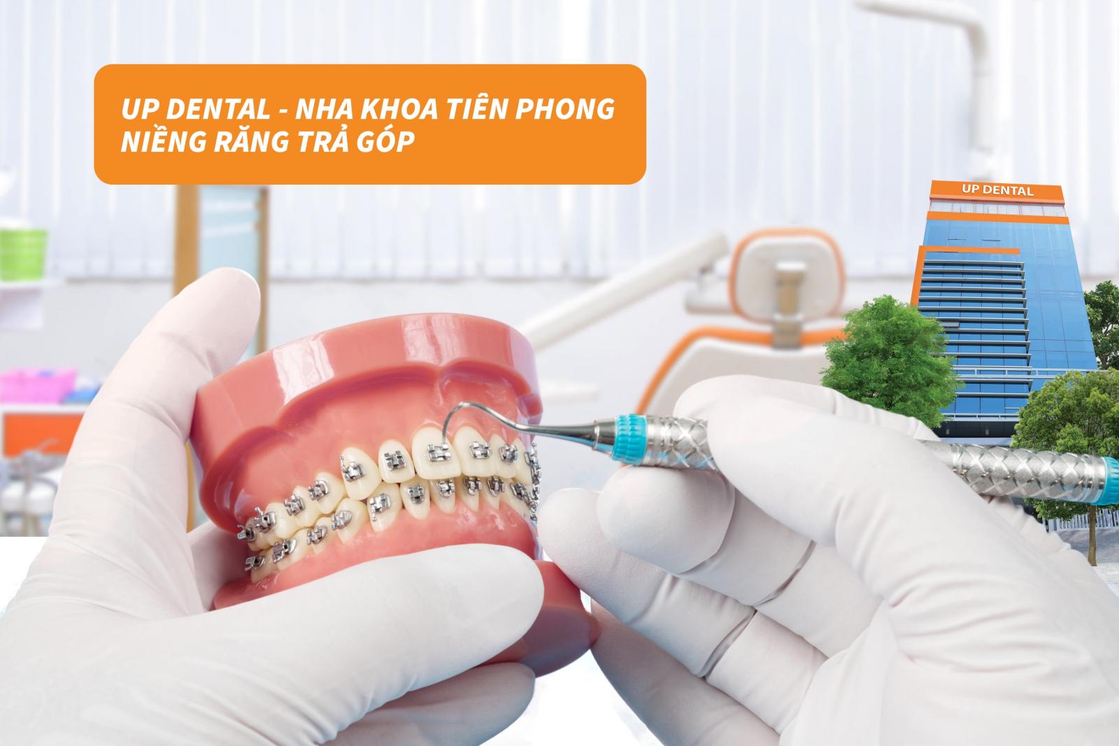 Up Dental - nha khoa tiên phong niềng răng trả góp