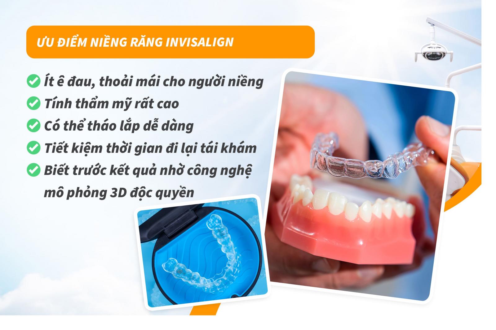 Ưu điểm niềng răng Invisalign