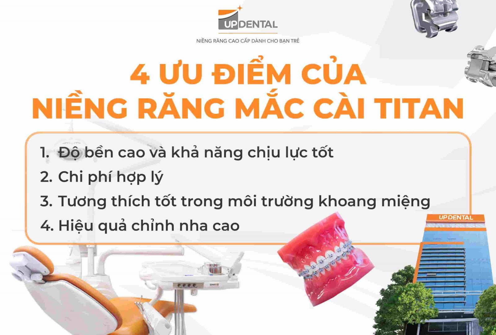 4 ưu điểm của niềng răng mắc cài Titan