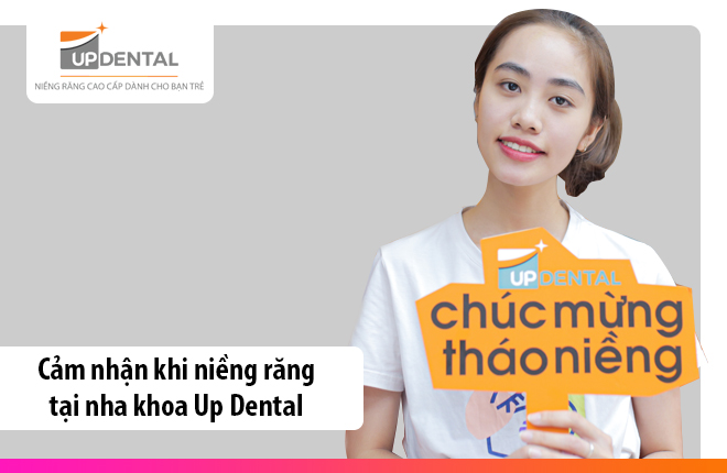 nieng-rang-tai-nha-khoa-up-dental