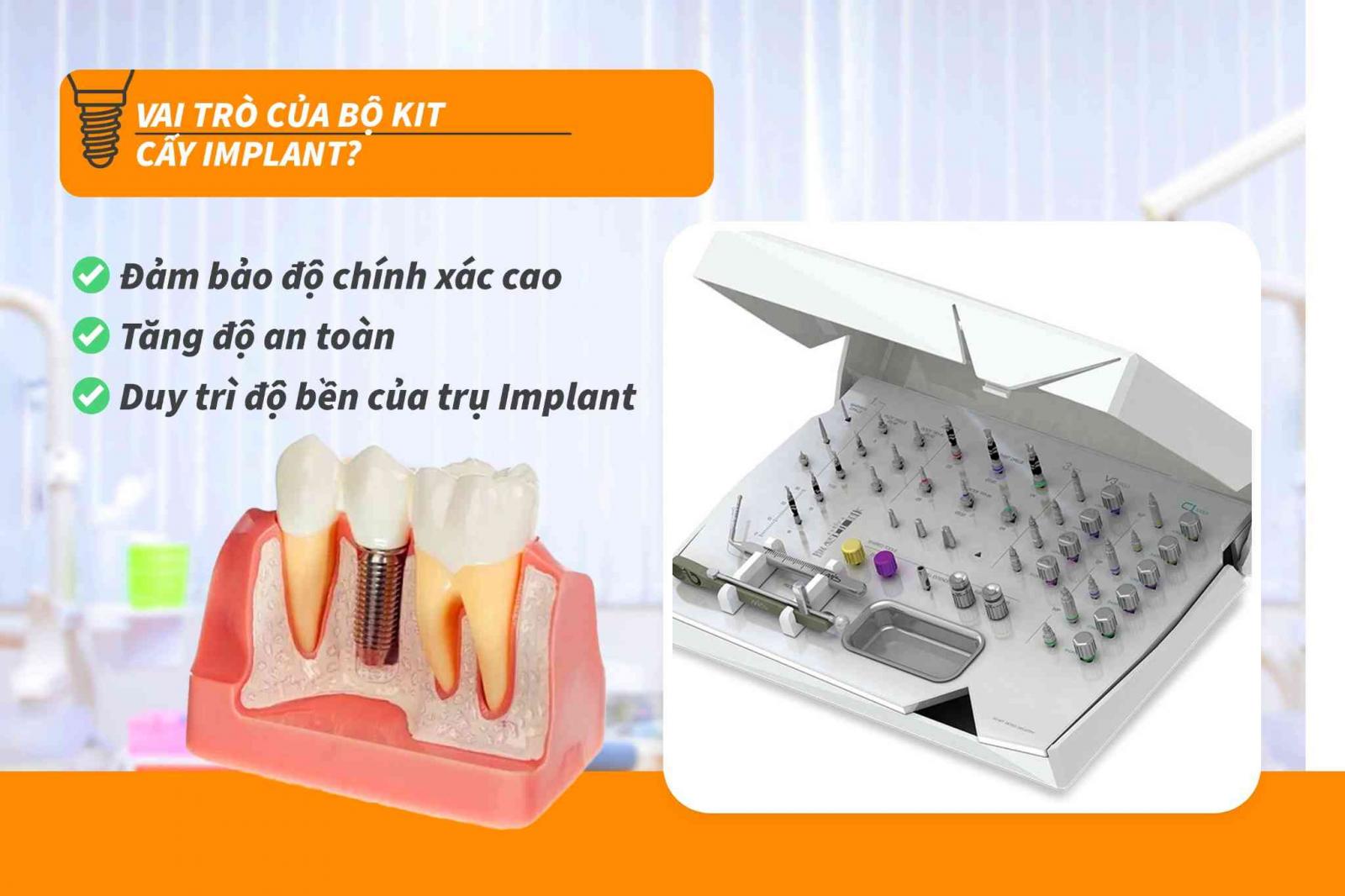 Vai trò của bộ kit cấy Implant