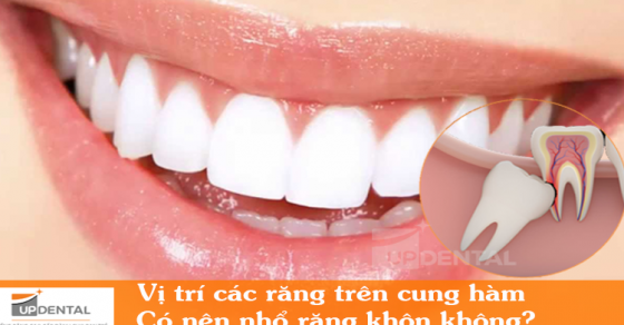 Vị trí các răng trên cung hàm | Up Dental