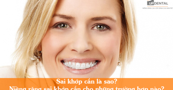 Sau quá trình niềng răng lệch khớp cắn, có cần phải tiếp tục điều chỉnh răng dài hạn không?
