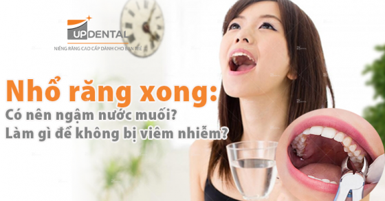 Có hạn chế gì về thời gian nếu muốn súc miệng bằng nước muối sau khi nhổ răng?
