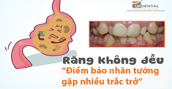 Tình trạng răng hàm dưới không đều có ảnh hưởng đến sức khỏe miệng và răng như thế nào?
