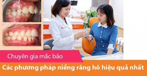 Cần chăm sóc như thế nào sau khi niềng răng?
