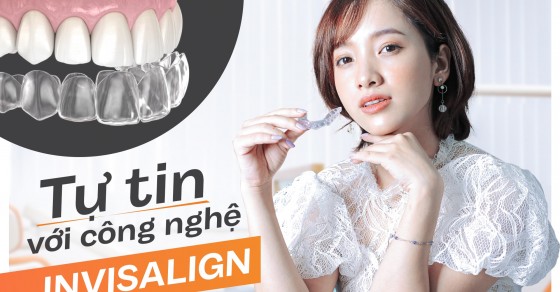 Quá trình điều chỉnh răng sử dụng Invisalign diễn ra như thế nào? 
