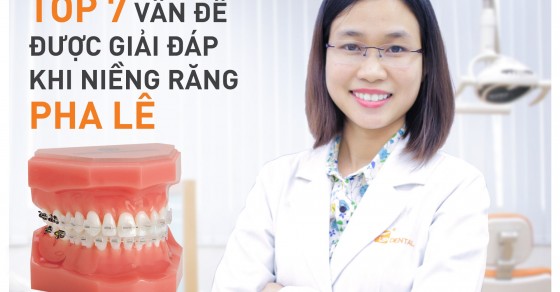 Phương pháp niềng răng bằng mắc cài pha lê có được cải tiến từ đâu?

