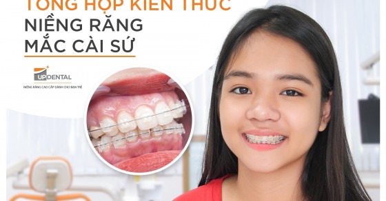 What is the process of getting dental braces with ceramic brackets using the method of niềng răng bằng mắc cài sứ and how does it help with teeth movement?
