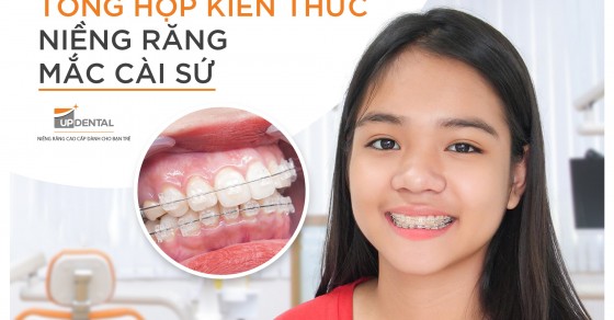 Những điều cần biết về niềng răng mắc cài sứ và hiệu quả của phương pháp này