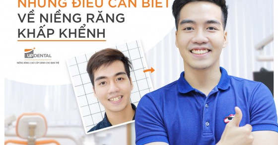 Quy trình niềng răng khấp khểnh bao gồm những bước gì?
