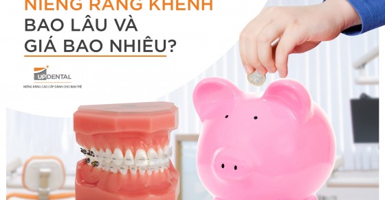 Độ tuổi phù hợp để thực hiện niềng răng khểnh 1 bên là bao nhiêu?
