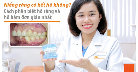 Phương pháp niềng răng trong suốt Invisalign được sử dụng cho răng hô hàm trên hay dưới?
