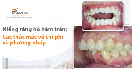 Phương pháp điều trị hiệu quả cho răng hô hàm trên là gì?
