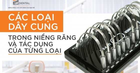 Cấu tạo và thành phần của dây cung niềng răng?
