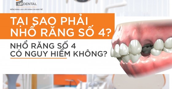 Nhổ răng số 4 có nguy hiểm không? 
