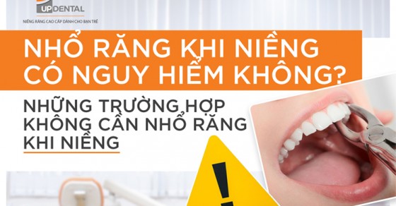 Nhổ răng nào là cần thiết để niềng răng?
