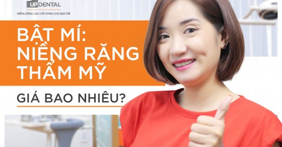 Bao lâu thì niềng răng có hiệu quả?
