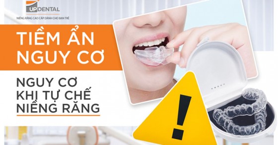 Tự niềng răng tại nhà có hiệu quả không?