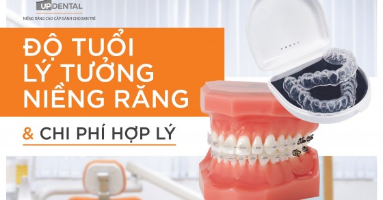 Tìm hiểu về khi nào cần niềng răng và lợi ích của quá trình niềng răng