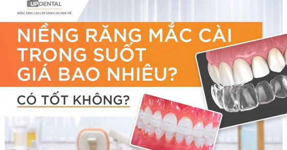 Mức độ đau đớn trong quá trình niềng răng trong suốt là như thế nào?
