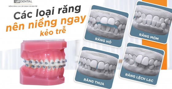 Niềng răng có cần phẫu thuật không?
