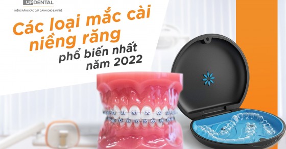 Đặc điểm nổi bật của mắc cài niềng răng kim loại truyền thống là gì?
