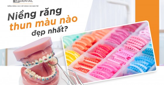 Người dùng muốn tìm kiếm thông tin về niềng răng có nhiều màu sắc khác nhau?