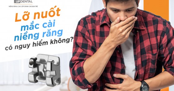 Các biện pháp phòng ngừa lỡ nuốt mắc cài niềng răng là gì?
