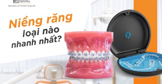 Loại nào niềng răng loại nào nhanh nhất ? Tìm hiểu quá trình niềng nhanh nhất