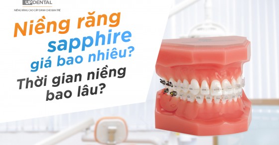 Tìm hiểu về niềng răng mắc cài sapphire và lợi ích của nó
