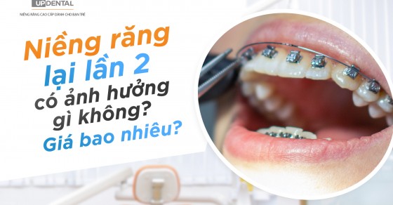 Điều kiện cần có để được niềng răng lần 2 là gì?

