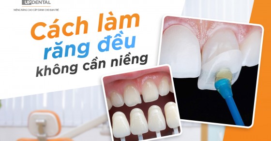 Làm sao để đảm bảo an toàn khi thực hiện phương pháp chỉnh nha tại nhà?
