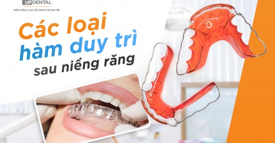 Quy trình chăm sóc hàm duy trì sau niềng răng là gì?
