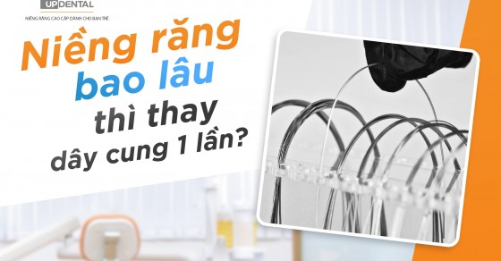 Chất liệu của dây cung niềng răng là gì và tác dụng của từng thành phần trong chất liệu đó?
