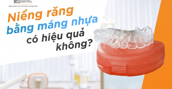 Niềng răng bằng máng trong suốt có nhược điểm gì?
