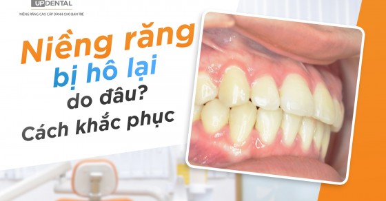 Nha khoa có thể giúp xử lý những bất thường liên quan đến răng hô sau khi niềng?
