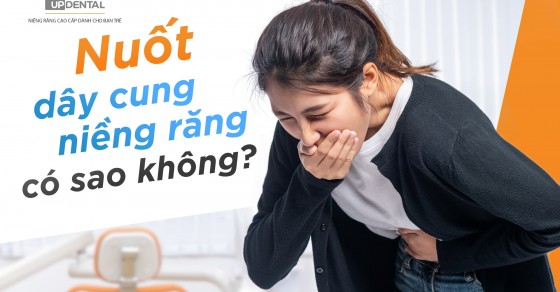 Nuốt dây cung niềng răng có sao không