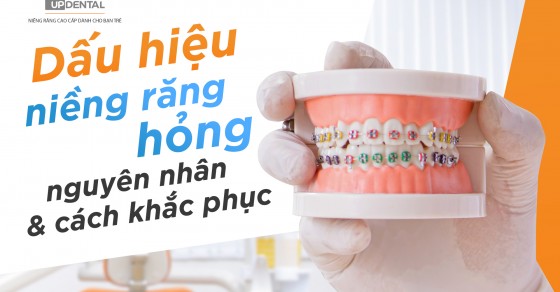 Hãy liệt kê các dấu hiệu khác để nhận biết niềng răng bị hỏng.
