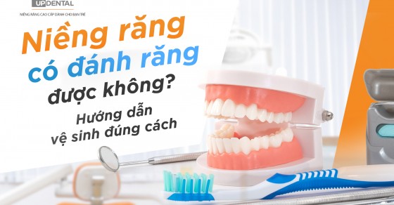 Bắt đầu từ khi nào nên đánh răng sau khi niềng?
