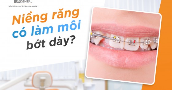 Tác động của răng vẩu môi dày đến sức khỏe và ngoại hình của người bệnh?
