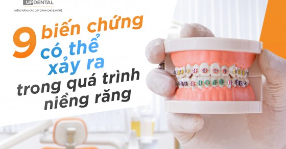 Có nguy cơ gặp phản ứng dị ứng khi niềng răng không?
