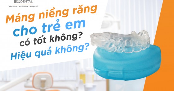 Tại sao máng niềng răng được sử dụng cho trẻ em?
