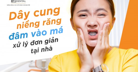 Có những nguyên nhân nào khiến dây cung niềng răng đâm vào má?
